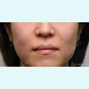 聖心美容クリニック 名古屋院 加藤 大典医師の症例