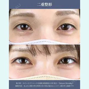 ネビュラクリニック 広島院 白岩 拓巳医師の症例