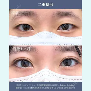 ネビュラクリニック 広島院 白岩 拓巳医師の症例