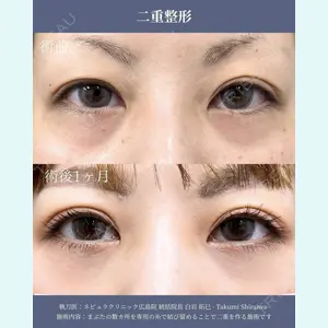 ネビュラクリニック 広島院 白岩 拓巳医師の症例