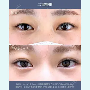 ネビュラクリニック 広島院 白岩 拓巳医師の症例