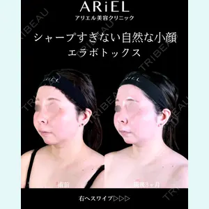 アリエル美容クリニック 郡山院 安齋 誠基医師の症例