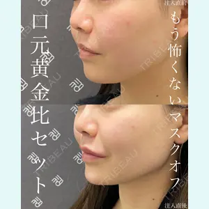 EMMO FACE CLINIC 大宮院 廣松 直樹医師の症例