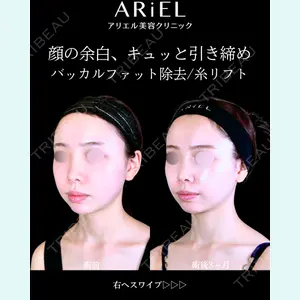 アリエル美容クリニック 郡山院 安齋 誠基医師の症例