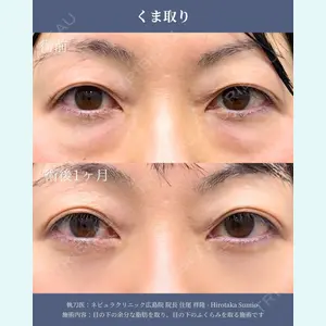 ネビュラクリニック 広島院 住尾 祥隆医師の症例