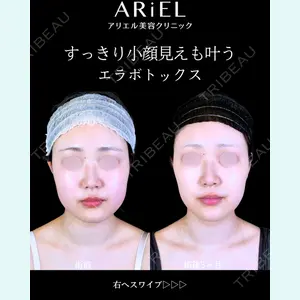 アリエル美容クリニック 郡山院 安齋 誠基医師の症例
