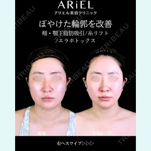 アリエル美容クリニック 郡山院 安齋 誠基医師の症例