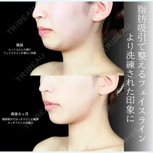 アリエル美容クリニック 横浜院 渡邉 光医師の症例