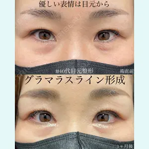 EMMO FACE CLINIC 大宮院 廣松 直樹医師の症例