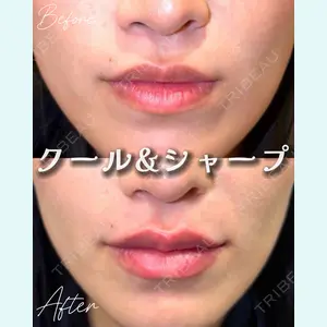 Tokyo Tensei Clinic 新宿院 小瀬 洸春医師の症例