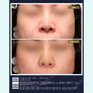 聖心美容クリニック 広島院 中辻 隆徳医師の症例