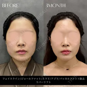 RIVER CLINIC（リバークリニック）大阪院の症例