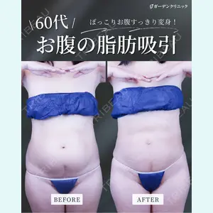 ガーデンクリニック 名古屋院 安立 弘太医師の症例