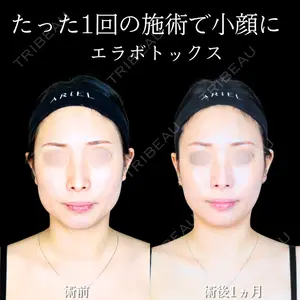 アリエル美容クリニック 大宮院 江郷隼一郎医師の症例