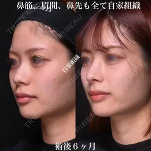 Zetith Beauty Clinic 銀座院 鉄 鑠医師の症例