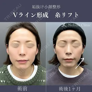 ネビュラクリニック 広島院 住尾 祥隆医師の症例