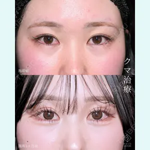 藤・ナチュレ美容クリニック 銀座院 小川 杏平医師の症例