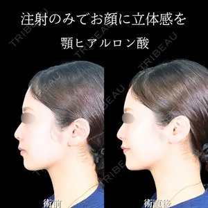 アリエル美容クリニック 大宮院 鈴木　桂介医師の症例