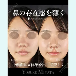 シンデレラ＆ダヴィンチクリニック 宮田 洋佑医師の症例