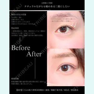 東京シンデレラ美容外科 大宮院 竹田 昌平医師の症例