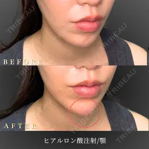 BiBiクリニック 山本 幸一郎医師の症例