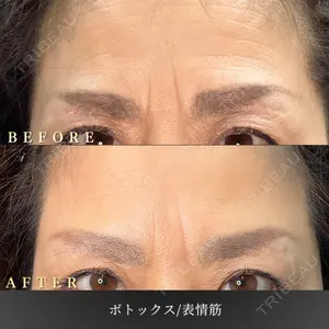 BiBiクリニック 山本 幸一郎医師の症例