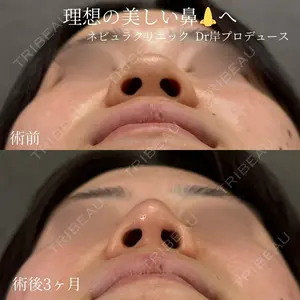 ネビュラクリニック 京都院 岸 大輔医師の症例