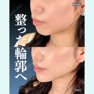 神戸美容外科 ネビュラクリニック 岩﨑 雅医師の症例