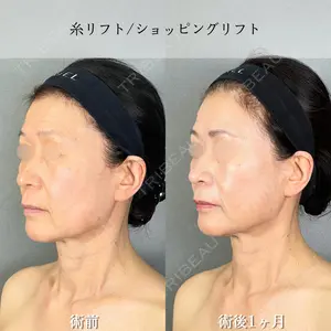 アリエル美容クリニック 大宮院 鈴木　桂介医師の症例