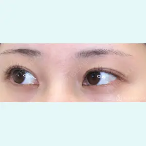 聖心美容クリニック 福岡院 美原 寿之医師の症例