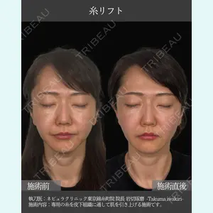 ネビュラクリニック 東京錦糸町院 岩切 琢磨医師の症例