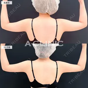 A CLINIC（エークリニック） 大阪院 田窪 賢志郎医師の症例