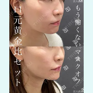 EMMO FACE CLINIC 大宮院 廣松 直樹医師の症例