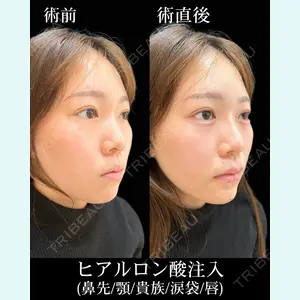 HAAB×DREAM BEAUTY CLINIC 東京本院 佐野 圭医師の症例