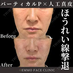 EMMO FACE CLINIC 東京三田院 木之下 哲彦医師の症例
