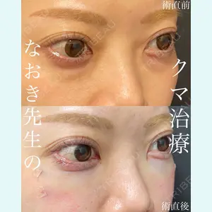 EMMO FACE CLINIC 大宮院 廣松 直樹医師の症例