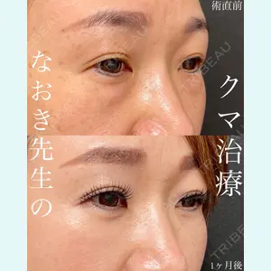 EMMO FACE CLINIC 大宮院 廣松 直樹医師の症例