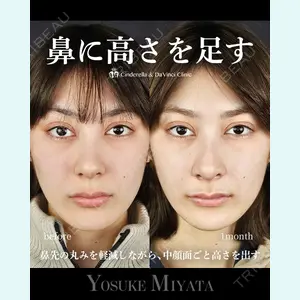 シンデレラ＆ダヴィンチクリニック 宮田 洋佑医師の症例