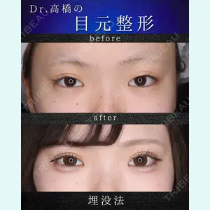 吉祥寺アイビークリニック 高橋 京佑 医師の症例