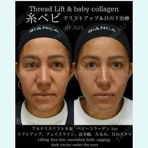 BIANCA銀座 横山 歩依里医師の症例