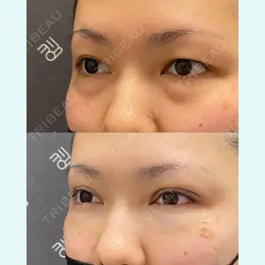 EMMO FACE CLINIC 大宮院 廣松 直樹医師の症例