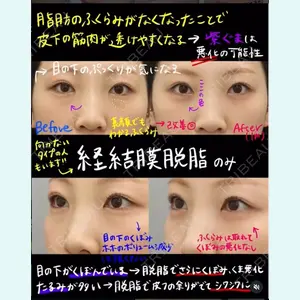 銀座みゆき通り美容外科 大阪梅田院 北澤真歩医師の症例