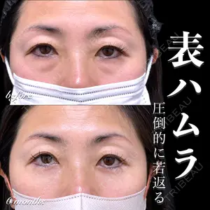 EMMO FACE CLINIC 大宮院 百瀬 直也医師の症例