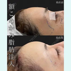 EMMO FACE CLINIC 大宮院 廣松 直樹医師の症例