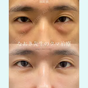 EMMO FACE CLINIC 大宮院 廣松 直樹医師の症例