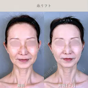 アリエル美容クリニック 水戸院 天白 典秀医師の症例