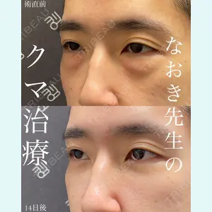 EMMO FACE CLINIC 大宮院 廣松 直樹医師の症例