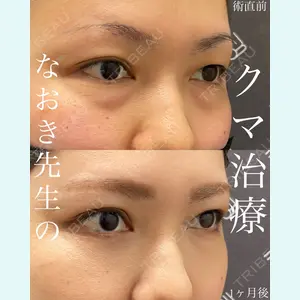 EMMO FACE CLINIC 大宮院 廣松 直樹医師の症例