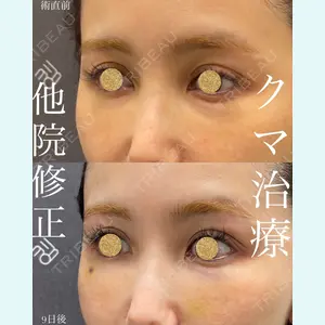 EMMO FACE CLINIC 大宮院 廣松 直樹医師の症例