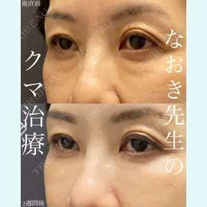 EMMO FACE CLINIC 大宮院 廣松 直樹医師の症例